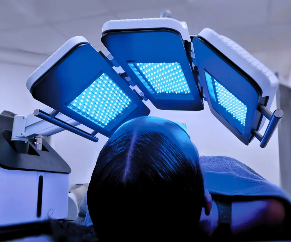Tratamento com Compact Lite: painéis de LED azul sobre o couro cabeludo de um paciente